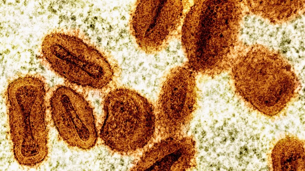 FILE - This colorized electron microscope image provided by the National Institute of Allergy and Infectious Diseases in 2024 shows Mpox virus particles, orange, found within infected cells, green. (